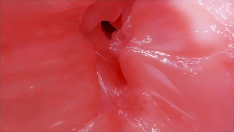 Aemeath - Deep Internal Speculum Inspection Part 2